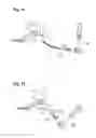 Fig. 07 - Bone nail for the heel
