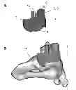 Fig. 01 - SURGICAL INSTRUMENT FOR THE POSITIONING OF AN ALIGNMENT ELEMENT