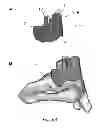Fig. 08 - SURGICAL INSTRUMENT FOR THE POSITIONING OF AN ALIGNMENT ELEMENT