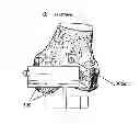 Fig. 01 - Surgical templates