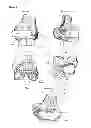 Fig. 08 - Surgical templates