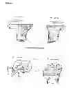 Fig. 13 - Surgical templates