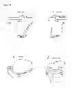 Fig. 15 - Surgical templates