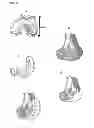 Fig. 22 - Surgical templates
