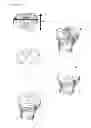 Fig. 23 - Surgical templates