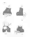 Fig. 32 - Surgical templates