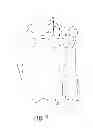 Fig. 05 - Customized patient-specific bone cutting blocks