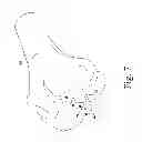 Fig. 08 - Customized patient-specific bone cutting blocks