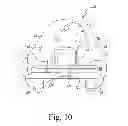 Fig. 11 - Customized patient-specific bone cutting blocks