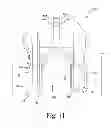 Fig. 12 - Customized patient-specific bone cutting blocks