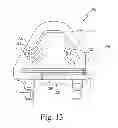 Fig. 14 - Customized patient-specific bone cutting blocks