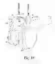 Fig. 17 - Customized patient-specific bone cutting blocks