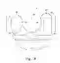 Fig. 19 - Customized patient-specific bone cutting blocks