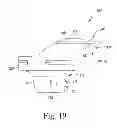 Fig. 20 - Customized patient-specific bone cutting blocks
