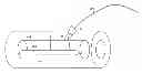 Fig. 01 - Apparatus for delivery of reinforcing materials to bone