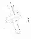 Fig. 05 - Controlled force surgical implant impaction instrument