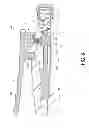 Fig. 09 - Controlled force surgical implant impaction instrument