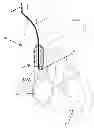 Fig. 01 - Positioning methods for intravascular electrode arrays for neuromodulation