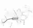 Fig. 03 - Positioning methods for intravascular electrode arrays for neuromodulation