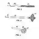 Fig. 03 - Temporary vascular scaffold and scoring device