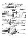 Fig. 04 - Temporary vascular scaffold and scoring device
