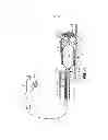 Fig. 06 - Temporary vascular scaffold and scoring device