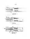 Fig. 07 - Temporary vascular scaffold and scoring device