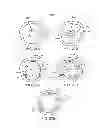 Fig. 16 - Temporary vascular scaffold and scoring device