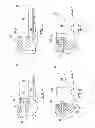 Fig. 04 - Tissue removal device for neurosurgical and spinal surgery applications