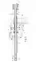 Fig. 10 - Tissue removal device for neurosurgical and spinal surgery applications