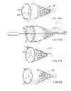 Fig. 45 - EMBOLIC PROTECTION SYSTEM