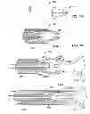 Fig. 49 - EMBOLIC PROTECTION SYSTEM