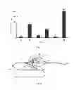 Fig. 02 - INSTRUMENT FOR CAPTURING FREE THROMBI