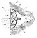 Fig. 01 - Joint assembly for medical devices