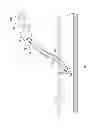 Fig. 40 - Systems and Methods for Improved Vessel Access Closure