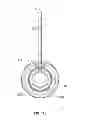 Fig. 52 - Systems and Methods for Improved Vessel Access Closure