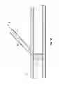 Fig. 69 - Systems and Methods for Improved Vessel Access Closure