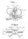 Fig. 02 - Vascular hole closure device