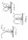 Fig. 03 - Vascular hole closure device