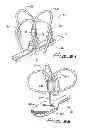 Fig. 05 - Vascular hole closure device