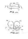 Fig. 11 - Vascular hole closure device