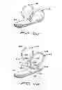 Fig. 12 - Vascular hole closure device