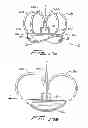 Fig. 29 - Vascular hole closure device