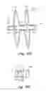 Fig. 07 - Catch Member for PFO Occluder