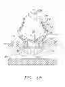 Fig. 09 - Sheath apparatus and methods for delivering a closure device