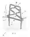 Fig. 06 - Adjustable Compression Staple and Method for Stapling With Adjustable Compression