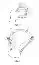 Fig. 02 - Knotless suture anchor and methods of use