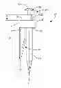 Fig. 01 - SURGICAL IMPLANT SYSTEM AND METHOD