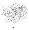 Fig. 03 - SURGICAL IMPLANT SYSTEM AND METHOD