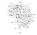 Fig. 06 - SURGICAL IMPLANT SYSTEM AND METHOD
